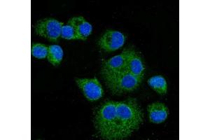 IF analysis of CPT1A using anti-CPT1A antibody (ABIN7599853).