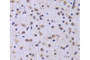 Immunohistochemistry of paraffin-embedded Rat brain using NUDC Polyclonal Antibody at dilution of 1:100 (40x lens). (NUDC 抗体)