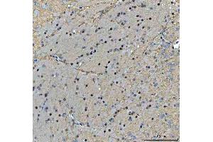 IHC analysis of TIGD1 using anti-TIGD1 antibody (ABIN7602407).