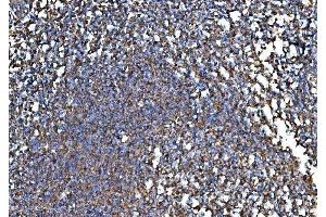 IHC analysis of RPL32 using anti-RPL32 antibody (ABIN7601826). (RPL32 抗体  (AA 48-129))
