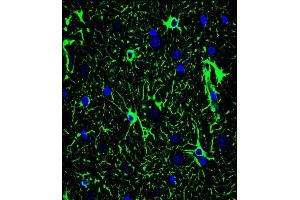Confocal immunofluorescent analysis of GF Antibody (ABIN659067 and ABIN2838068) with brain tissue followed by Alexa Fluor® 488-conjugated goat anti-mouse lgG (green). (GFAP 抗体)
