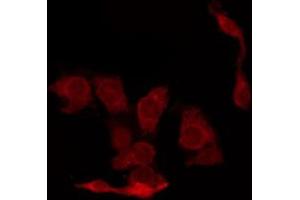 ABIN6267448 staining A2780 by IF/ICC. (CDK2 抗体  (pThr160))