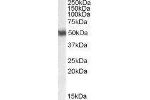 Western Blotting (WB) image for Retinoic Acid Receptor, alpha (RARA) peptide (ABIN369917) (Retinoic Acid Receptor, alpha (RARA) Peptide)