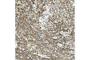 IHC analysis of VPS4A using anti-VPS4A antibody (ABIN7599531).