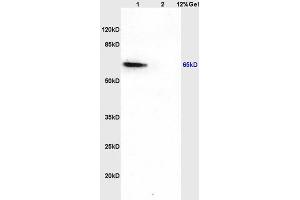 Lane 1: rat brain lysates Lane 2: rat liver lysates probed with Anti CDKAL1 Polyclonal Antibody, Unconjugated (ABIN873056) at 1:200 in 4 °C. (CDKAL1 抗体  (AA 375-460))