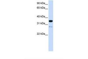 Image no. 1 for anti-Transmembrane Protein 38A (TMEM38A) (AA 74-123) antibody (ABIN6738623) (TMEM38A 抗体  (AA 74-123))