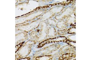 Immunohistochemistry (IHC) image for anti-Mast/stem Cell Growth Factor Receptor (KIT) (AA 25-295) antibody (ABIN6142896)