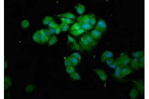 Immunofluorescence staining of MCF-7 cells with ABIN7163084 at 1:100, counter-stained with DAPI. (PNMT 抗体  (AA 1-176))