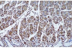 Immunohistochemistry of paraffin-embedded Human stomach using SFRP1 Polyclonal Antibody at dilution of 1:50 (20x lens). (SFRP1 抗体)