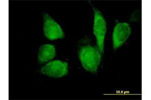 Immunofluorescence of purified MaxPab antibody to CDKN1B on HeLa cell. (CDKN1B 抗体  (AA 1-198))