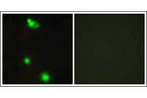Immunofluorescence analysis of MCF7 cells, using SFRS3 Antibody. (SRSF3 抗体  (C-Term))