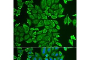 Immunofluorescence analysis of HeLa cells using APEH Polyclonal Antibody