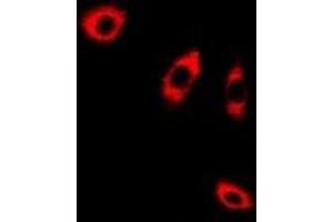 Immunofluorescent analysis of ANXA8L2 staining in A549 cells. (ANXA8L2 抗体)