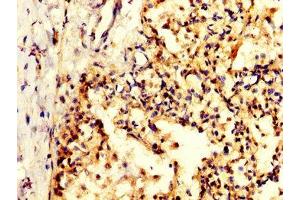 IHC image of ABIN7156276 diluted at 1:200 and staining in paraffin-embedded human lung tissue performed on a Leica BondTM system.
