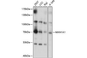 Western blot analysis of extracts of various cell lines, using M antibody (0830) at 1:1000 dilution.