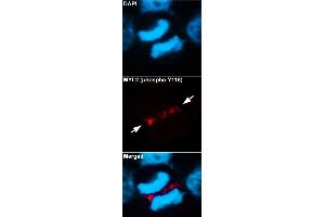 Immunofluorescent staining of methanol-fixed U87 cells using MYL2 (phospho Y118) polyclonal antibody  at 1:100-1:200 dilution. (MYL2 抗体  (pTyr118))