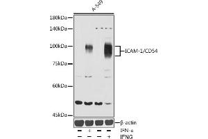 Western blot analysis of extracts of A-549 cells, using ICAM-1/CD54 antibody (ABIN6129231, ABIN6142118, ABIN6142120 and ABIN6221235) at 1:1000 dilution. (ICAM1 抗体  (AA 250-480))