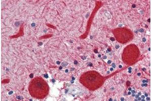Human Brain, Cerebellum (formalin-fixed, paraffin-embedded) stained with EMX2 antibody ABIN462168 followed by biotinylated goat anti-rabbit IgG secondary antibody ABIN481713, alkaline phosphatase-streptavidin and chromogen. (EMX2 抗体  (N-Term))