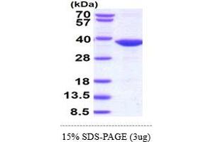 SDS-PAGE (SDS) image for Heterogeneous Nuclear Ribonucleoprotein K (HNRNPK) (AA 1-276) protein (His tag) (ABIN5853065) (HNRNPK Protein (AA 1-276) (His tag))