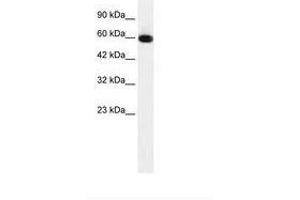 Image no. 1 for anti-GLIS Family Zinc Finger 2 (GLIS2) (AA 183-232) antibody (ABIN6735915) (GLIS2 抗体  (AA 183-232))