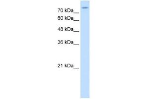 SLC20A2 antibody used at 1 ug/ml to detect target protein.