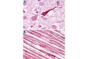 Immunohistochemistry (Formalin/PFA-fixed paraffin-embedded sections) of human brain (A) and human heart tissue (B) with GALR1 polyclonal antibody . (Galanin Receptor 1 抗体  (Extracellular Domain))