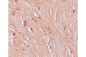 Immunohistochemistry (IHC) image for anti-Zinc Finger and BTB Domain Containing 3 (ZBTB3) (C-Term) antibody (ABIN1030811) (ZBTB3 抗体  (C-Term))