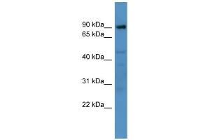 WB Suggested Anti-Adam22 Antibody Titration:  0. (ADAM22 抗体  (N-Term))