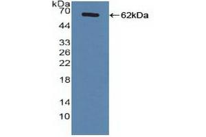 Detection of Recombinant FXR, Human using Polyclonal Antibody to Farnesoid X Receptor (FXR) (NR1H4 抗体  (AA 211-486))