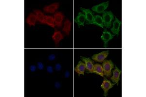 KC1AL Antibody staining HepG2 cells by IF/ICC. (CSNK1A1L 抗体  (C-Term))