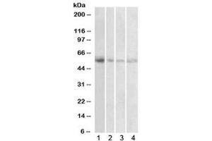 Western blot testing of human 1) placenta, 2) uterus, 3) adrenal gland and 4) pancreas lysate with VMAT2 antibody at 1ug/ml. (SLC18A2 抗体)