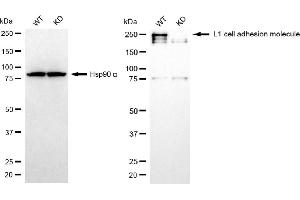 Western blotting analysis using L1 cell adhesion molecule antibody (ABIN7799220).
