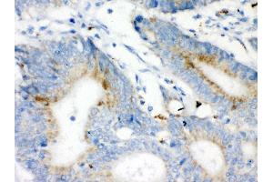 Immunohistochemistry (IHC) image for anti-Voltage-Dependent Anion Channel 1 (VDAC1) (AA 154-181), (Middle Region) antibody (ABIN3043959)