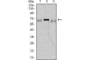 Western blot analysis using CD42B mouse mAb against K562 (1), HL-60 (2), and Ramos (3) cell lysate. (CD42b 抗体  (AA 17-183))