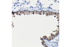 Immunohistochemistry of paraffin-embedded mouse lung using FUC Rabbit pAb (ABIN6127916, ABIN6140809, ABIN6140811 and ABIN6215812) at dilution of 1:200 (40x lens). (FUCA2 抗体  (AA 118-467))