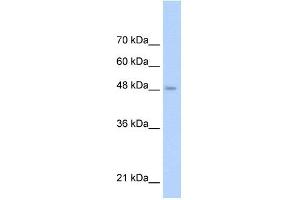 WB Suggested Anti-TLR6 Antibody Titration: 0. (TLR6 抗体  (Middle Region))