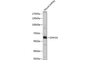 Western blot analysis of extracts of Mouse kidney using ZNF416 Polyclonal Antibody at dilution of 1:1000. (ZNF416 抗体)