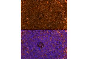 Immunofluorescence analysis of Rat spleen using FB antibody (ABIN6129339, ABIN6140465, ABIN6140466 and ABIN6224941) at dilution of 1:100. (FAM65B 抗体  (AA 1-210))