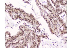IHC analysis of CRM1 using anti-CRM1 antibody . (XPO1 抗体  (AA 966-1071))
