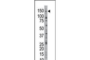 Antibody is used in Western blot to detect USP28 in Jurkat cell lysate. (USP28 抗体  (N-Term))
