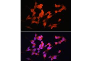 Immunofluorescence (IF) image for anti-ELAV-Like 3 (ELAVL3) (AA 1-100) antibody (ABIN6140118)
