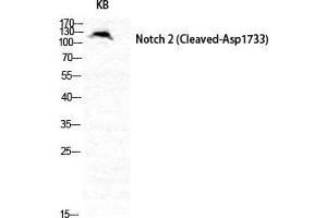 Western Blot (WB) analysis of specific cells using Cleaved-Notch 2 (D1733) Polyclonal Antibody. (NOTCH2 抗体  (Asp1733, cleaved))