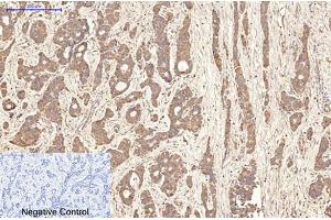 Immunohistochemical analysis of paraffin-embedded human liver cancer tissue. (Aquaporin 4 抗体)