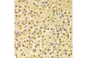Immunohistochemistry of paraffin-embedded mouse kidney using CDC25A antibody (ABIN5970519) at dilution of 1/100 (40x lens). (CDC25A 抗体)