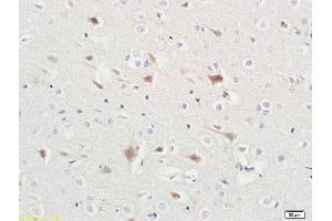 Formalin-fixed and paraffin embedded rat liver tissue labeled with Anti-ABHD5 Polyclonal Antibody, Unconjugated (ABIN708596) at 1:200 followed by conjugation to the secondary antibody and DAB staining (ABHD5 抗体  (AA 281-349))