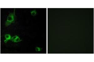 Immunofluorescence (IF) image for anti-Laminin, alpha 1 (LAMA1) (AA 2501-2550) antibody (ABIN2889998) (Laminin alpha 1 抗体  (AA 2501-2550))