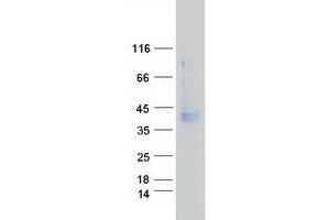 Western Blotting (WB) image for G Protein-Coupled Receptor, Family C, Group 5, Member A (GPRC5A) protein (Myc-DYKDDDDK Tag) (ABIN2722197)