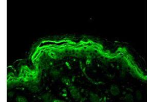 ERK 1/2 Immunofluorescence.