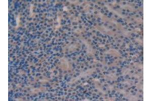 Immunohistochemistry (IHC) image for anti-Versican (Vcan) (AA 3058-3299) antibody (ABIN7434116)