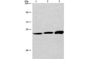 Western Blot analysis of adrenal pheochromocytoma tissue,Jurkat and A549 cell using VWA5A Polyclonal Antibody at dilution of 1:275 (VWA5A 抗体)